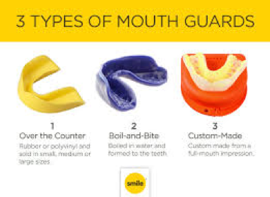 Mouthguards are important to protect your teeth