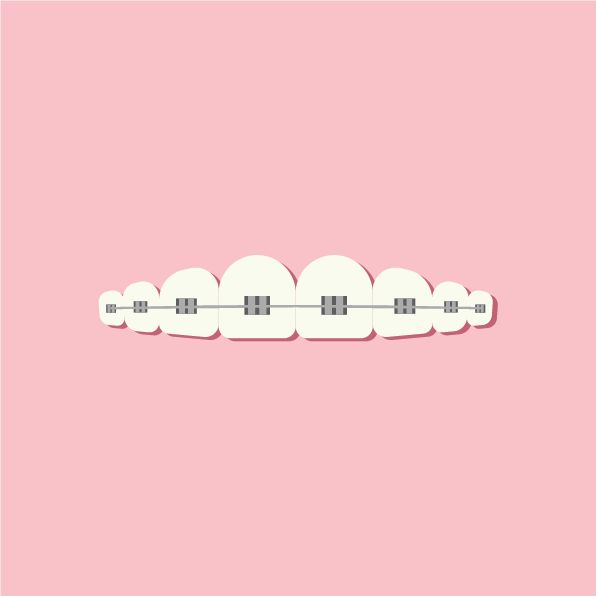 vector image of lower teeth with braces