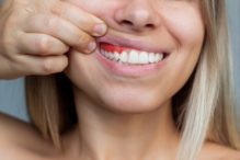 gum disease treatment in Olds