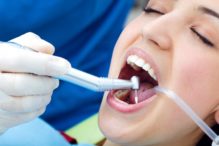 information about dental crowns