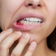 oral health and periodontitis
