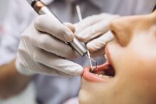 dental implants in Olds