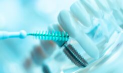 dental implants cleaning