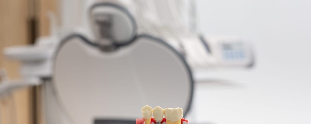 Dental Implants in Olds