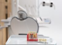 Dental Implants in Olds