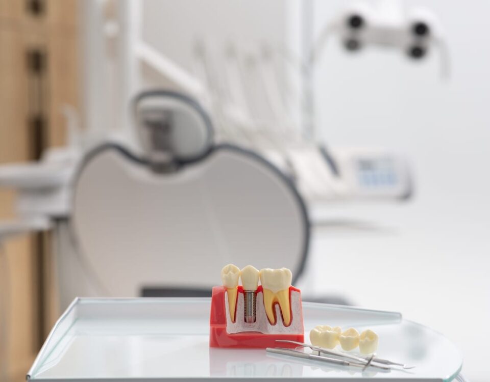 Dental Implants in Olds