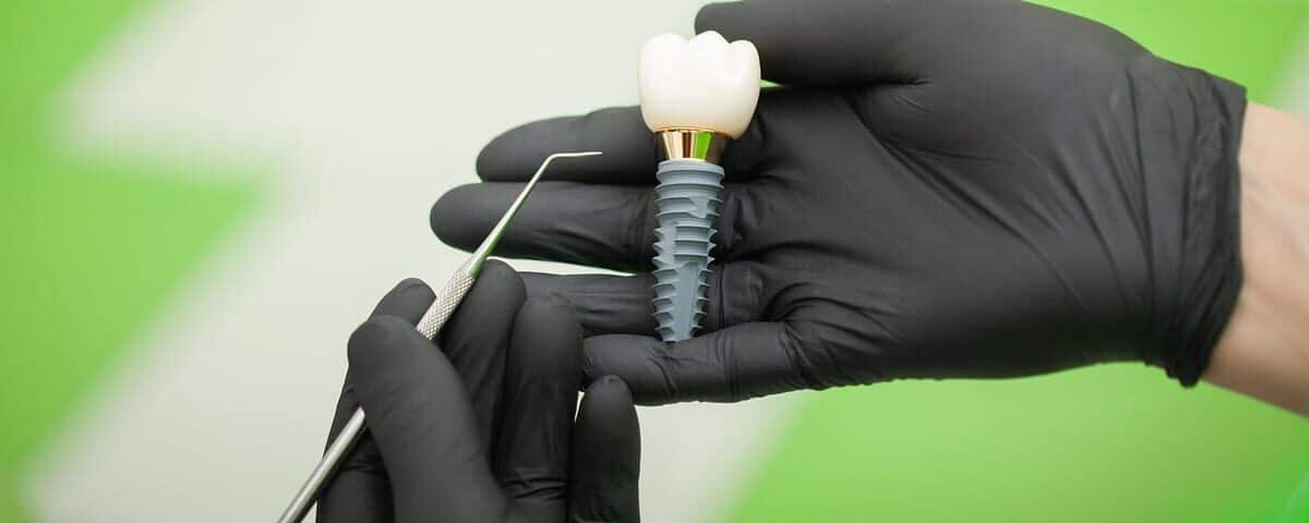 Dental Implants in Olds