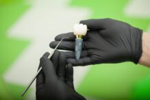 Dental Implants in Olds