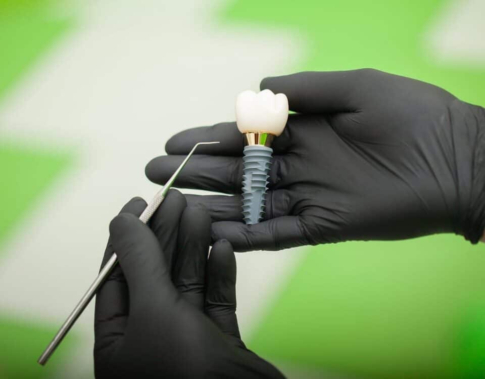 Dental Implants in Olds