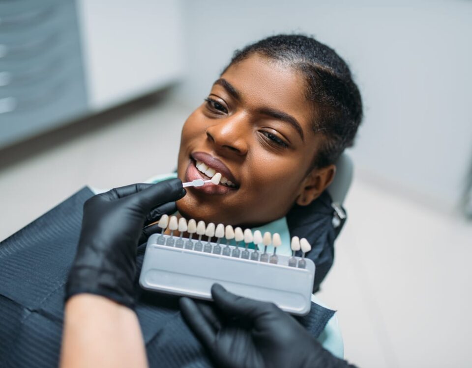 Veneers in Olds